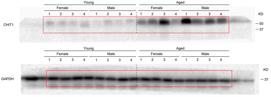 Nature:我國科學家揭示蛋白CHIT1促進靈長類動物脊髓中的運動神經元衰老(圖2) p25.png